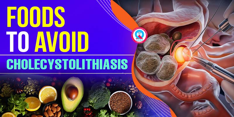 cholecystolithiasis-foods-to-avoid